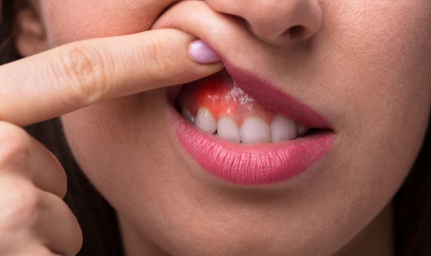 Gum disease - Valley Dental Care
