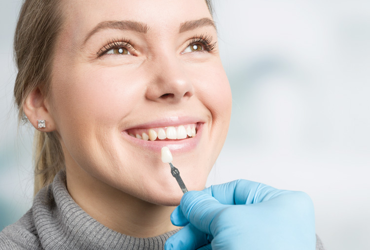 img-veneers